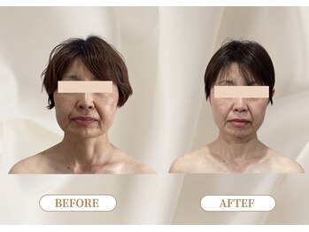 トロワ(TROIS)/つるんとしたおでこの秘密