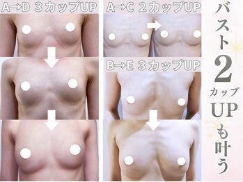 キアナ 横浜店(Kiana)/平均2~3カップバストアップ続出