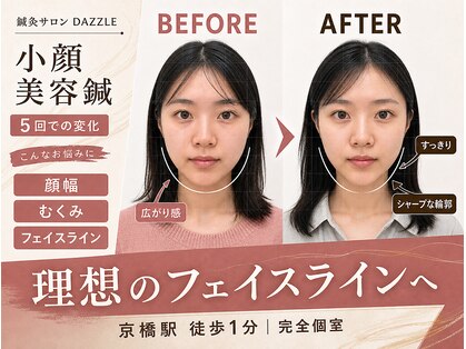 ダズル(DAZZLE)の写真