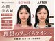 ダズル(DAZZLE)の写真
