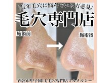 ミルメルシー(mille merci)