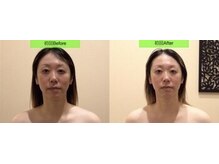 アジール 長岡リバーサイド千秋店(agir)/before/after画像