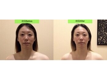 アジール 長岡リバーサイド千秋店(agir)/before/after画像