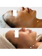 アズユウ(As U)/ハーブトリートメント