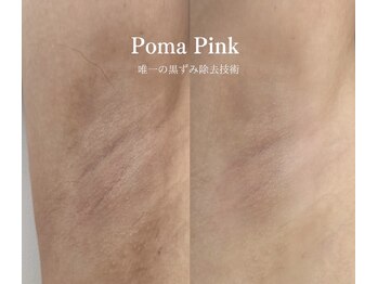 リュミエール デスポワール(Lumiere d'espoir)/ローマピンク