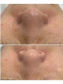 ヒルナム(Heal Nam)/~プロセルセラピーズ~ファイス