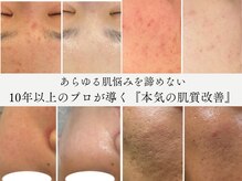 ノア 新宿(Noa)