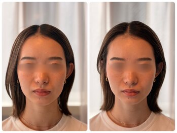 ルーツ 武蔵小杉(R∞ts)/向かって左に注目