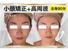 《輪郭の悩みに★小顔矯正＋プラチナRF》全身90分で理想の卵型Vライン形成！