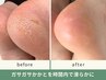 【足裏角質ケア(30分）】ちょっとだけ気になる角質に。　男性もOK!