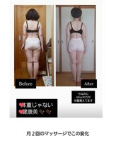ステラ(Stella)/【痩身】ボディリンパマッサージ