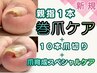 【巻爪1本・１０本爪切り・爪育成ケアスペシャル】