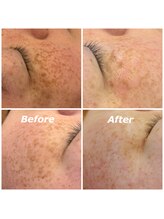 フォーケア(4Care)/ホワイトラボ