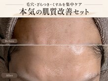 ヘリ(HERI.)の雰囲気（オーダーメイド肌質改善【シミ／毛穴／ニキビ／ハーブ】）