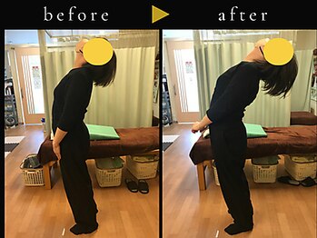 杉本接骨鍼灸院/若々しい背骨を取り戻す整体