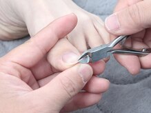 あゆむ鍼灸接骨院/★施術風景★巻き爪.陥入爪.