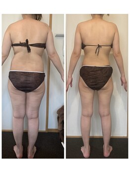 ボンテ(bonte)/6ヶ月で-14ｋｇ！