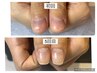【自爪育成ジェルお試し】ピンクの部分を伸ばし縦長な綺麗な爪にしたい方