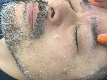 シェア(SHARE)の写真/脱毛＋お肌のお悩みケアならSHAREにお任せ下さい♪プロの技術でお肌のお悩みを徹底改善し、ハリ・ツヤUP◎