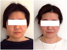 美容整体 ウェリナ 蟹江院/小顔矯正/骨盤矯正/美脚サロン 