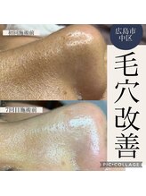 ジェンヌ(jenne.)/毛穴ケアならお任せください