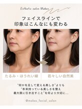 メイクス(Makes)/切らない！小顔フェイスリフト