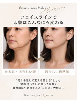 メイクス(Makes)/切らない!小顔フェイスリフト