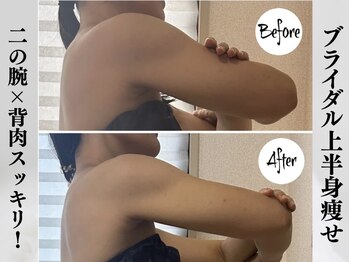 シーフェイス 横浜店(SEE FACE)の写真/背肉・はみ肉・二の腕たるみスッキリ！肩こりや疲労にも効果的◎上半身痩せを目指し理想のボディラインへ♪