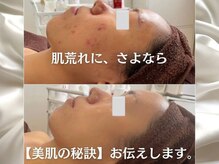ファシル(Facile)の雰囲気（オーダーメイドハーブピーリング）