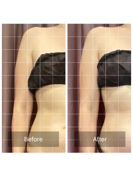 フリージア(Freesia)/ご来店のHさま(初回)