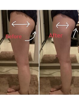 クレアボディ(CREA BODY)/ヒップ太もも