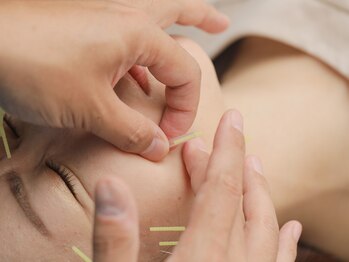 オカモト鍼灸整骨院/お肌のお悩みにおススメ!