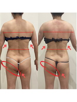 シュエットプラス(Chouette+)/ハミ肉二の腕は上半身太くみせる