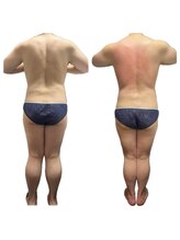 美温(mion)/花嫁様のゆるゆる痩身