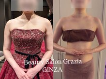 グラツィア 銀座(Grazia)/8回【 ブライダルエステ整体 】