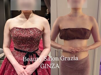 グラツィア 銀座(Grazia)/8回【 ブライダルエステ整体 】