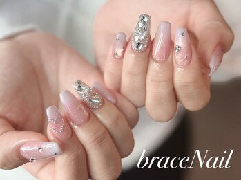 ブレスネイル(brace Nail)