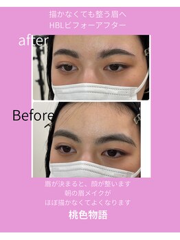 桃色物語/眉コンプレックス改善HBL