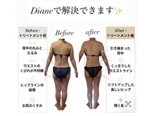 ディアンヌ(Diane)
