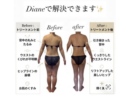 ディアンヌ(Diane)の写真