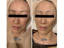 ブランシュール/エンビロンフルコース 