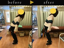 杉本接骨鍼灸院/若々しい背骨を取り戻す整体