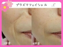 ソーハート(So Heart)/☆大人気！エイジングケアに特化