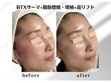 アールメディカルサロン 富山院(R Medical Salon)/ハリ艶アップ小顔
