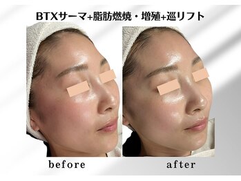 アールメディカルサロン 富山院(R Medical Salon)/ハリ艶アップ小顔