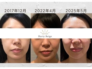 ハリーベージュ(Hariy Beige)/HariyBeige麻布十番