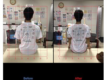 ストレチックス 近江八幡店/ストレッチ ビフォーアフター