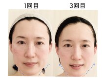 エスツリービューティーアンドネイル(S-TREE BEAUTY&NAIL)の雰囲気（骨格矯正でお顔の土台から整え本来の美しさを引き出します。）