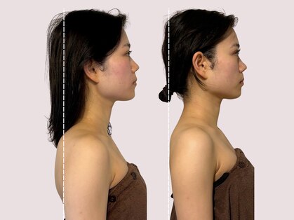 ミライ小顏 烏丸御池店(MIRAI小顏)の写真