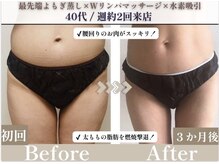 ヨサパーク ココ(YOSA PARK COCO)の雰囲気（深部リンパマッサージで全身のリンパの流れを促進♪）
